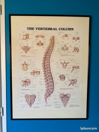 Poster Affiche anatomique colonne vertébrale encadrée sous verre